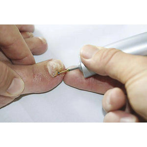 Fraise 1SXM Carbure de tungstène - Enucléation des cors - 2,1 mm - My Podologie