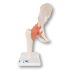Deluxe Functional Model of the Hip Joint - Anatomy and Pathology