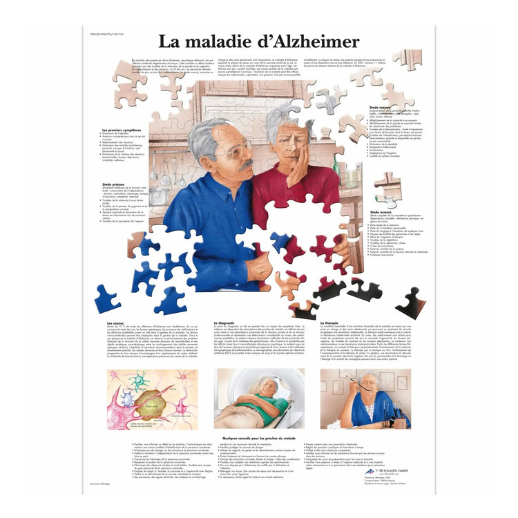 Planche anatomique - La maladie d'Alzheimer - Anatomie et pathologie - My Podologie