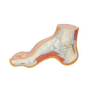Skeleton of a hollow foot (Pes Cavus)