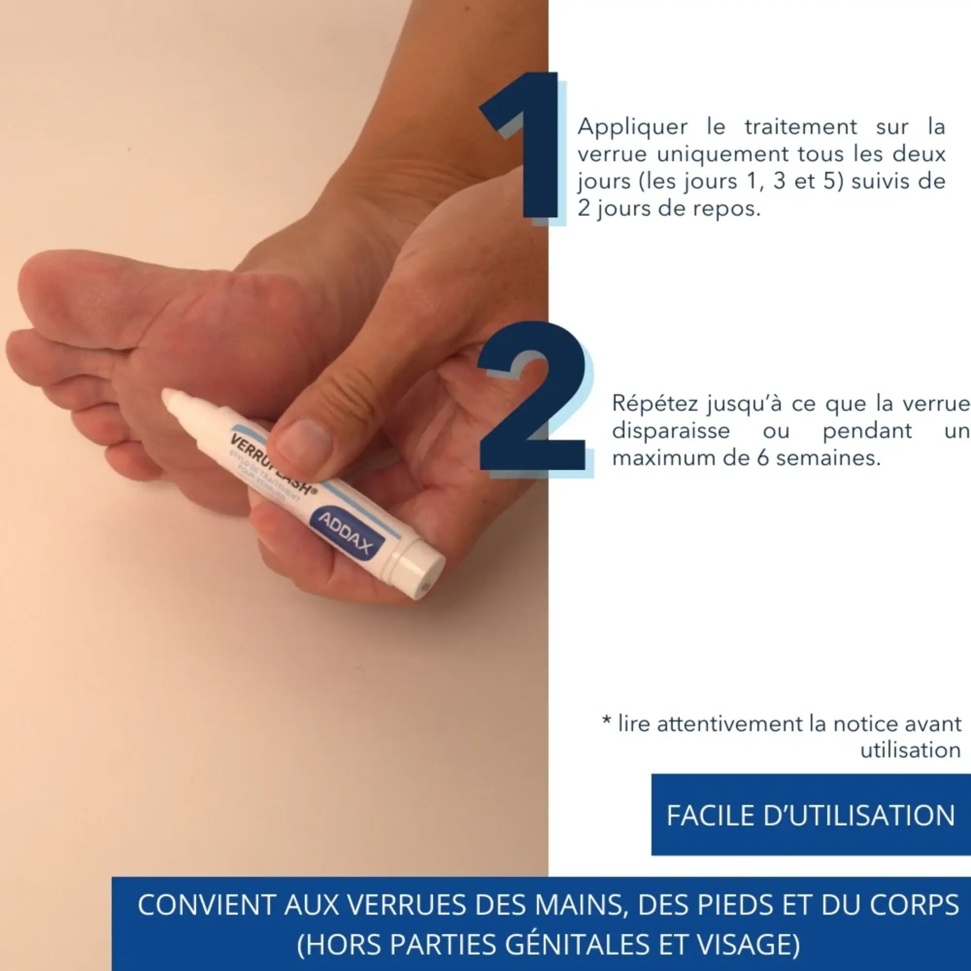 VERRUFLASH® Stylo - Traitement Verrues mains, pieds et corps - 3 ml - Laboratoire Addax Laboratoire Addax 